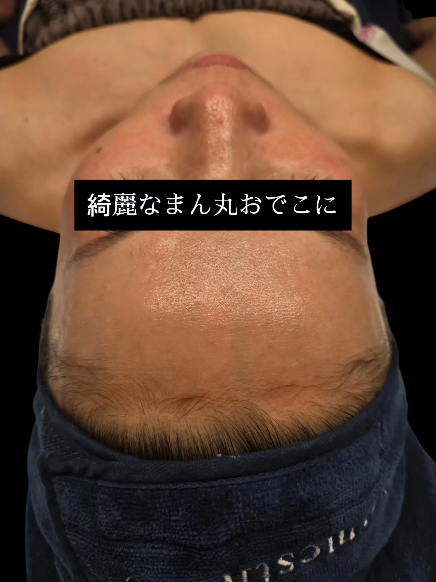 【SUPERJECTION】