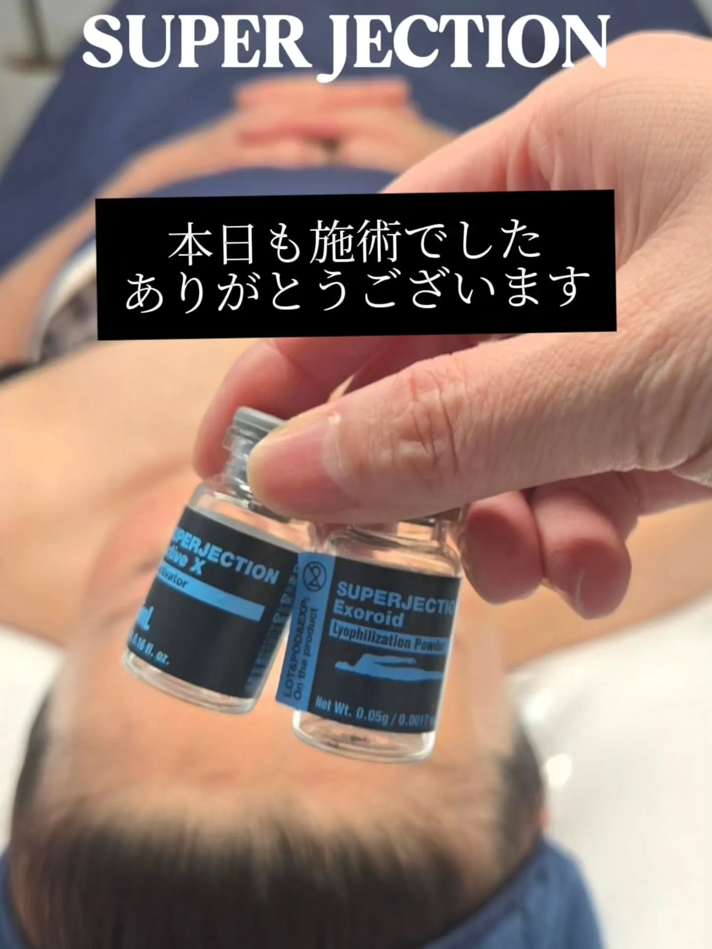 【SUPERJECTION】