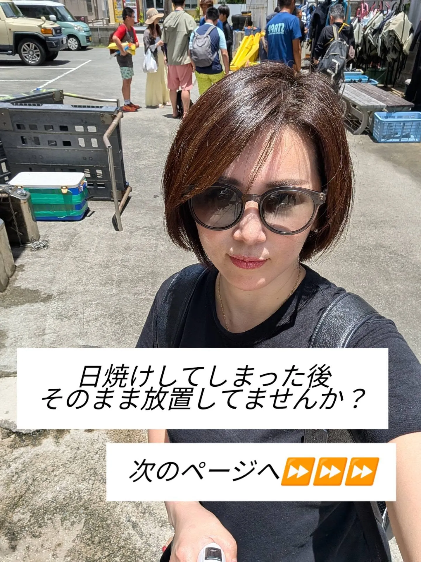 日焼けした日の対処法🚨