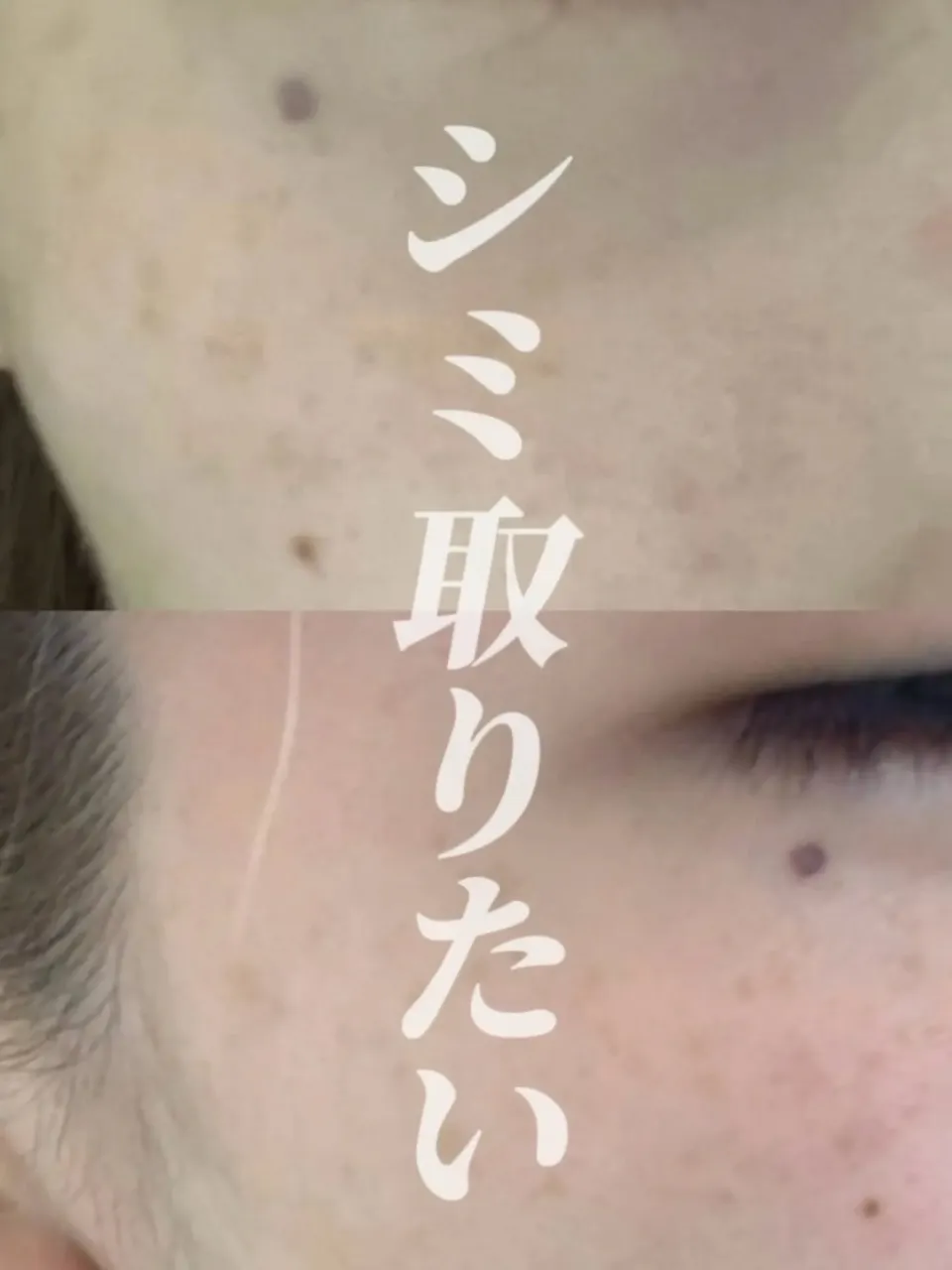 🍋MINTAVI 20｜純粋ビタミンC 20%