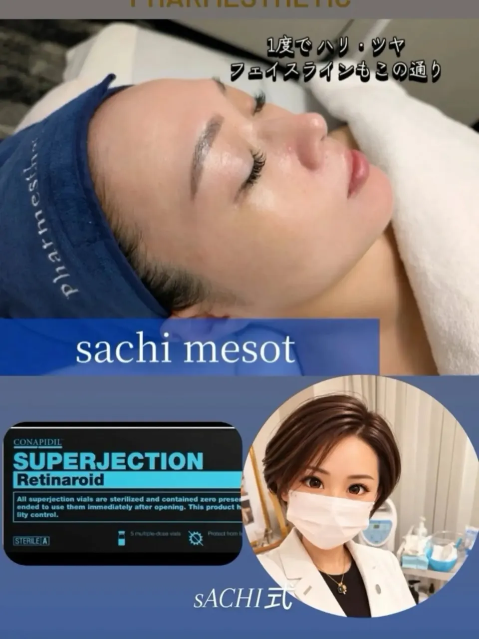 スーパージェクションの良さってなんだろう。