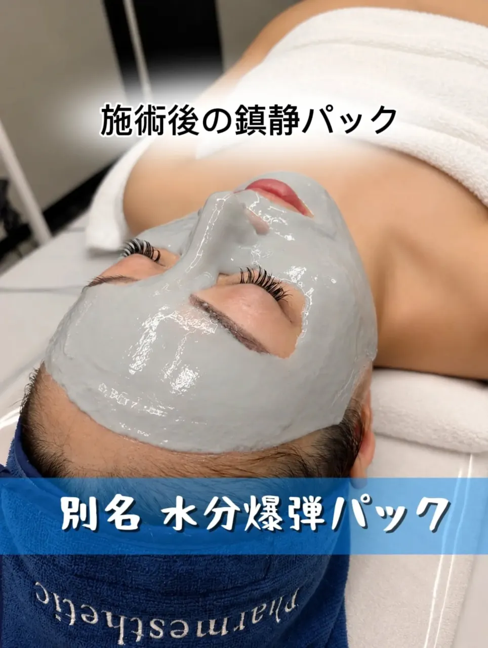 スーパージェクションの良さってなんだろう。